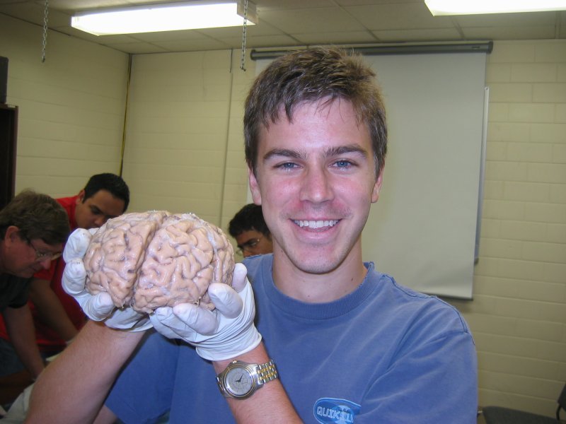 File:Tyler Olsen and brain.jpg